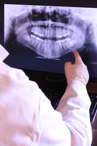 Best Broken Tooth Emergency  in Fountain Inn, SC