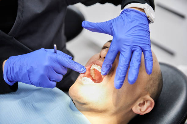 Best Cracked Tooth Emergency Dentist  in Fountain Inn, SC
